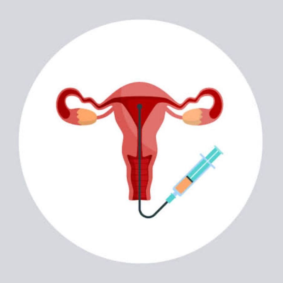 Aşılama (IUI) Nedir?